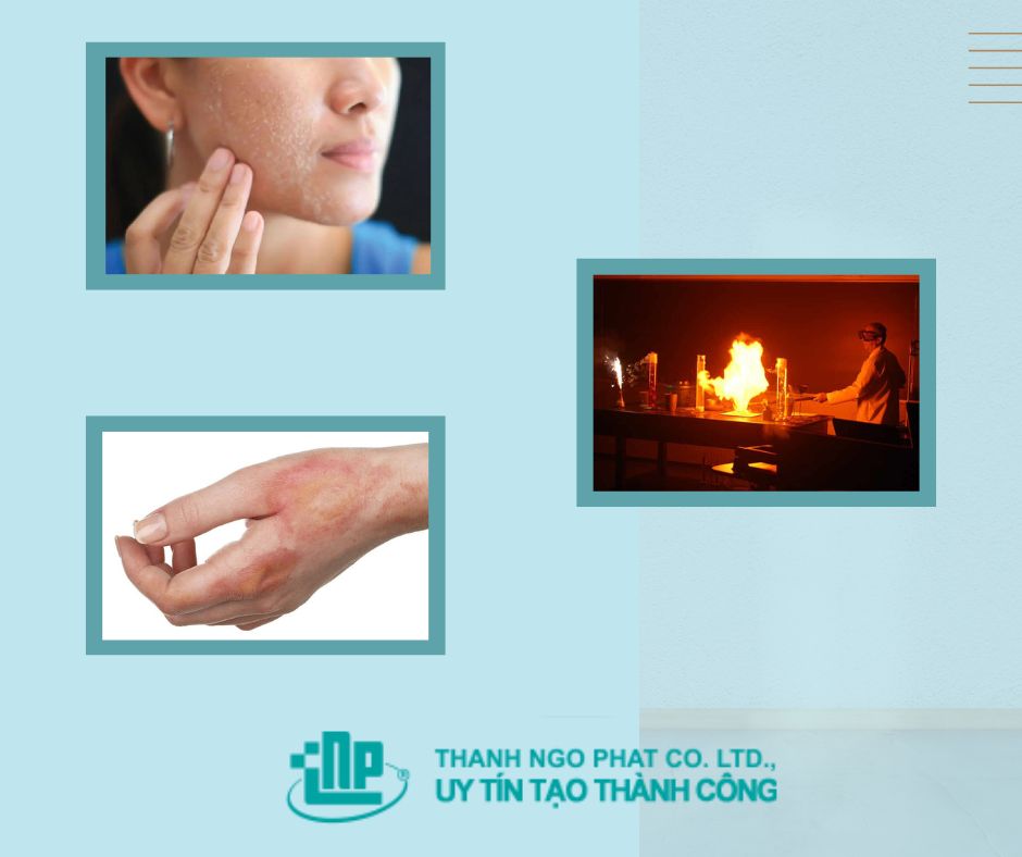 Cồn 90 độ có diệt khuẩn được không