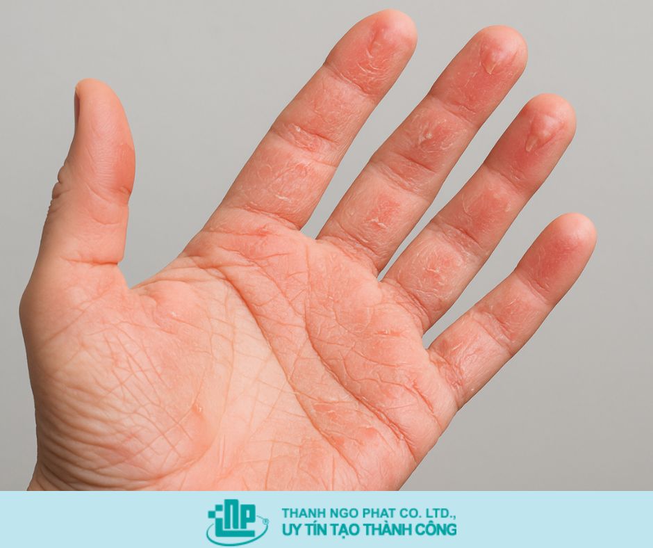 ETHANOL TRONG SỮA TẮM CÓ TỐT KHÔNG? ƯU & NHƯỢC ĐIỂM CẦN NẮM RÕ 3 ethanol trong sữa tắm